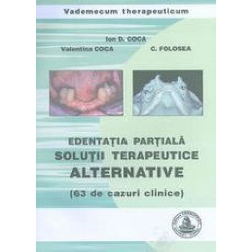 EDENTATIA PARTIALA – SOLUTII TERAPEUTICE ALTERNATIVE - 63 de cazuri clinice) – I. COCA, V. COCA